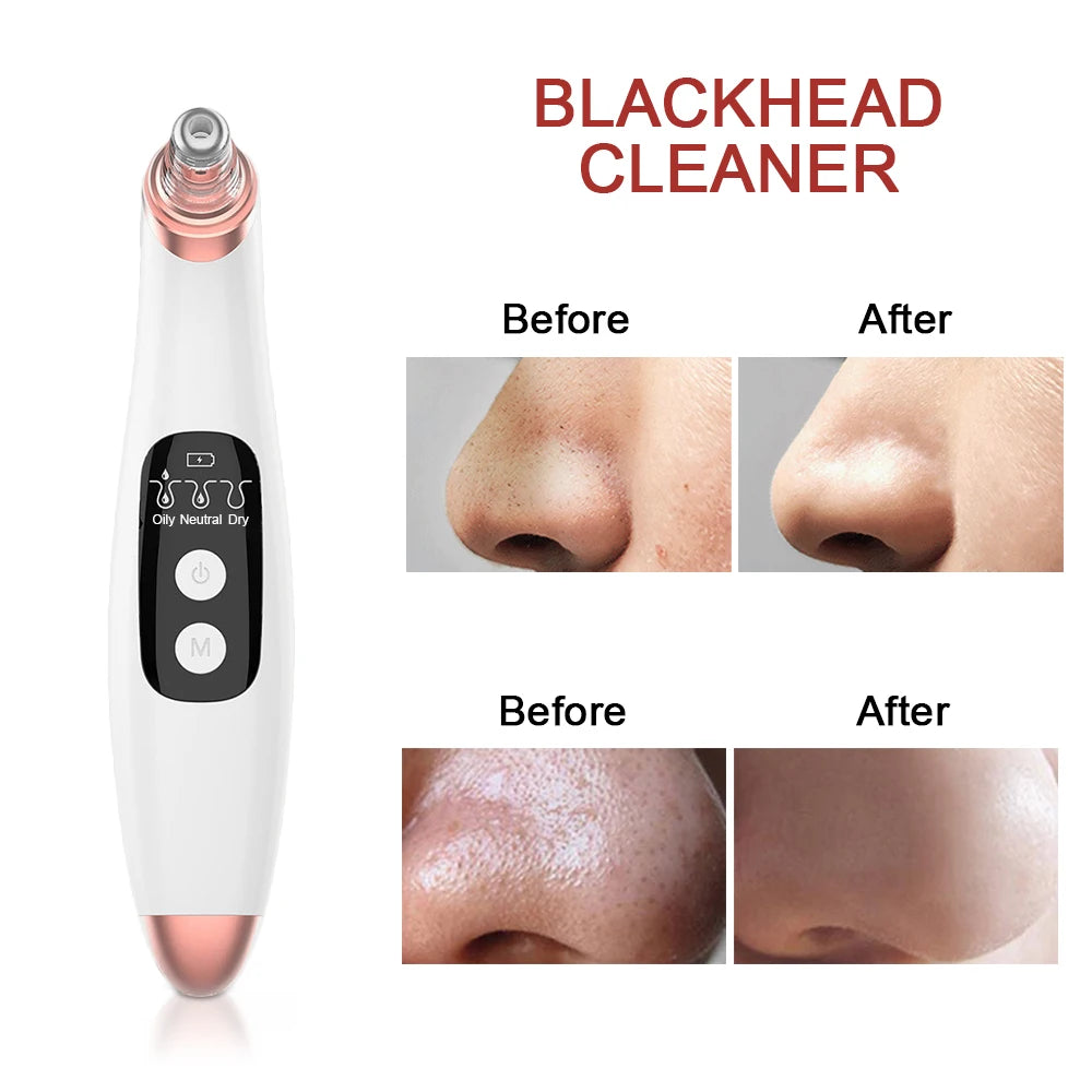 5-in-1 Ultrasonic Skin Scrubber & Facial Beauty Kit – Deep Clean, Lift, Glow