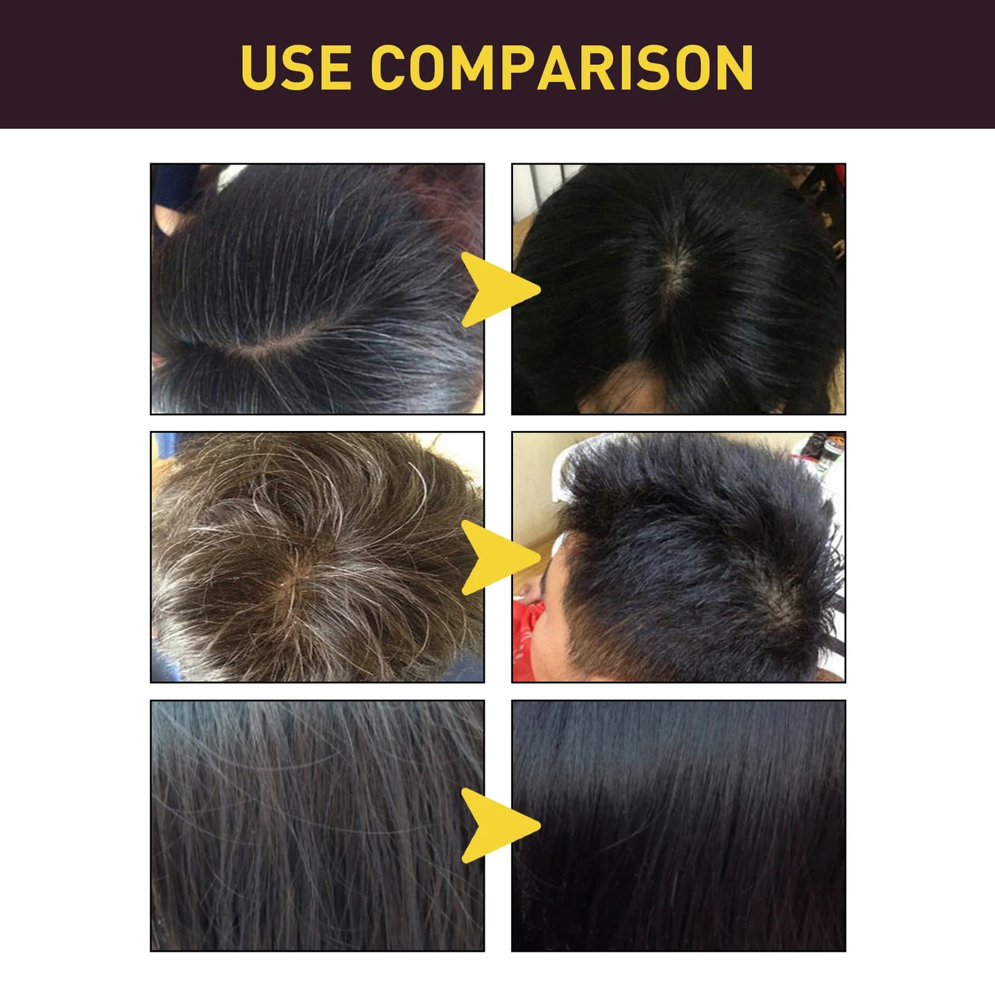 EELHOE 100ml Natural Plant Hair Dye Shampoo – 3-in-1 Grey Coverage for Men & Women