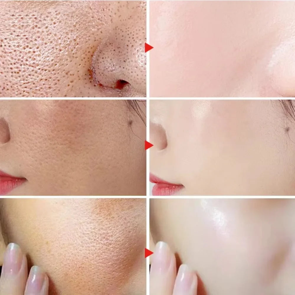 🌿 Lactic Acid Pore Minimizing Serum – Hydrating & Smoothing Korean Skincare