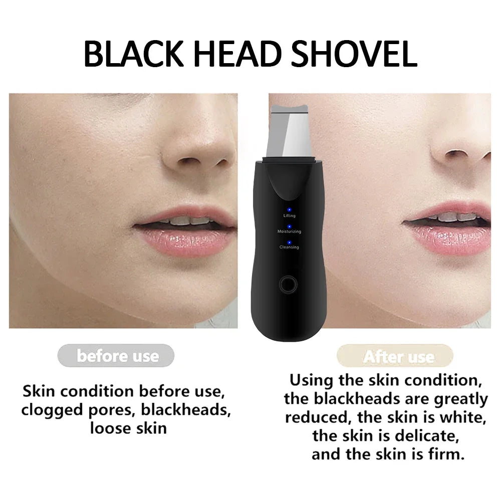 5-in-1 Ultrasonic Skin Scrubber & Facial Beauty Kit – Deep Clean, Lift, Glow