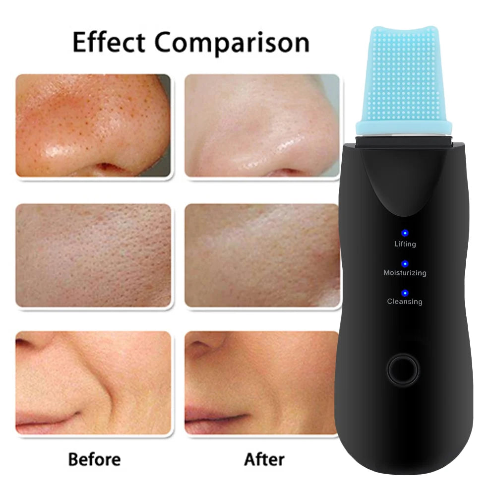 5-in-1 Ultrasonic Skin Scrubber & Facial Beauty Kit – Deep Clean, Lift, Glow