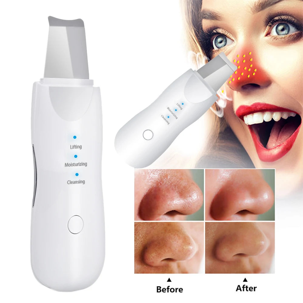 5-in-1 Ultrasonic Skin Scrubber & Facial Beauty Kit – Deep Clean, Lift, Glow