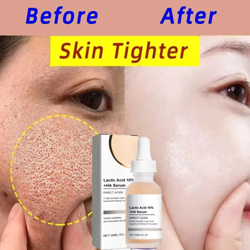🌿 Lactic Acid Pore Minimizing Serum – Hydrating & Smoothing Korean Skincare