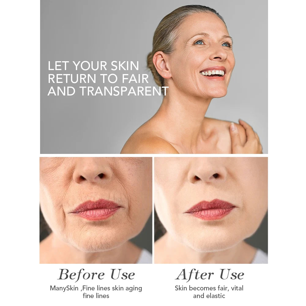 Whitening & Moisturizing Facial Mask – Vitamin C & Hyaluronic Acid Hydration Treatment 💧✨