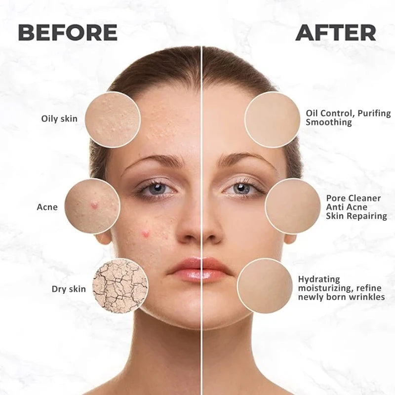 Professional Jelly Face Mask Powder – Hyaluronic Acid Hydrating & Whitening Peel Mask 💆‍♀️✨