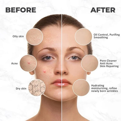 Professional Jelly Face Mask Powder – Hyaluronic Acid Hydrating & Whitening Peel Mask 💆‍♀️✨