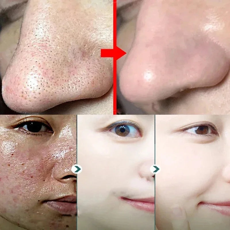 Green Tea Blackhead Remover Mask Stick