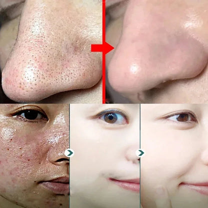 Green Tea Blackhead Remover Mask Stick