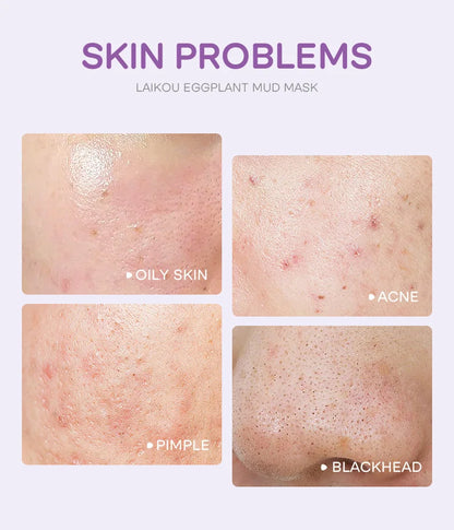 Eggplant Mud Mask Set (5pcs)