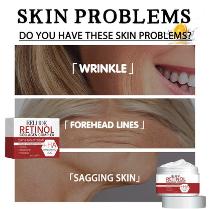 Anti-Wrinkle Retinol Collagen Cream