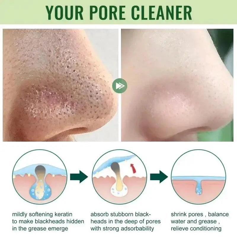Green Tea Blackhead Remover Mask Stick