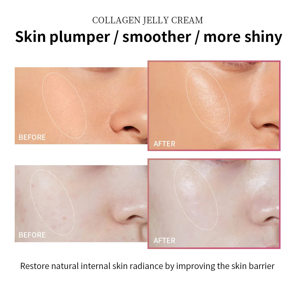 Anti-Aging Collagen Face Cream – Niacinamide Moisturizer for Firming & Hydration (100ml) 💧✨