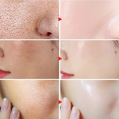 🌿 Lactic Acid Pore Minimizing Serum – Hydrating & Smoothing Korean Skincare