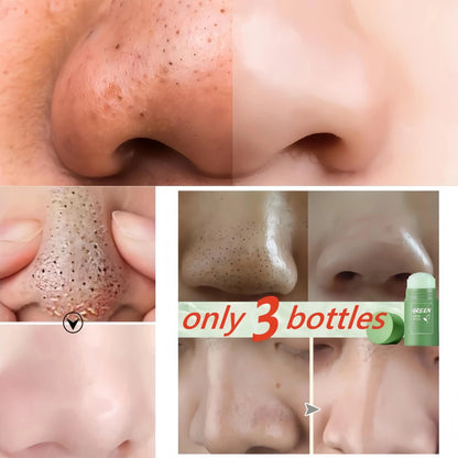Green Tea Blackhead Remover Mask Stick
