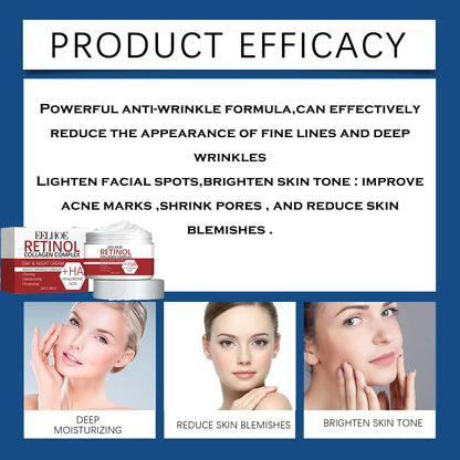 Anti-Wrinkle Retinol Collagen Cream