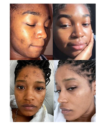 Natural Skin Cleansing & Brightening Set