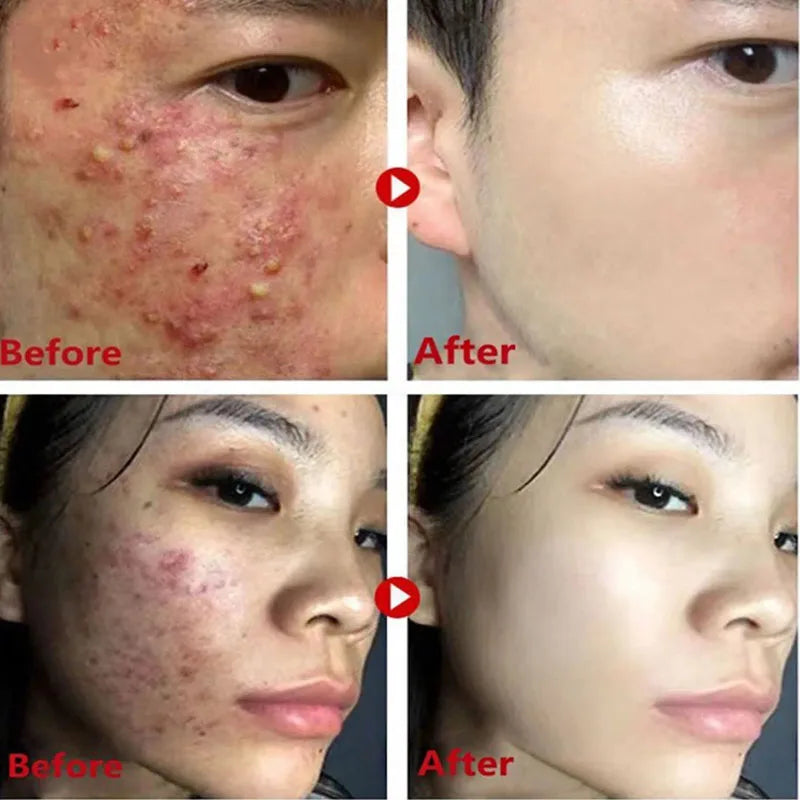 Green Tea Blackhead Remover Mask Stick