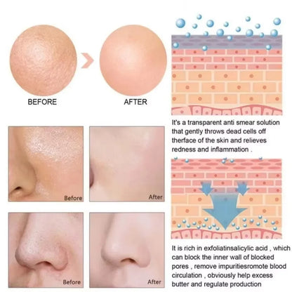 🌿 Lactic Acid Pore Minimizing Serum – Hydrating & Smoothing Korean Skincare