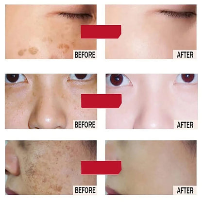 Whitening & Moisturizing Facial Mask – Vitamin C & Hyaluronic Acid Hydration Treatment 💧✨