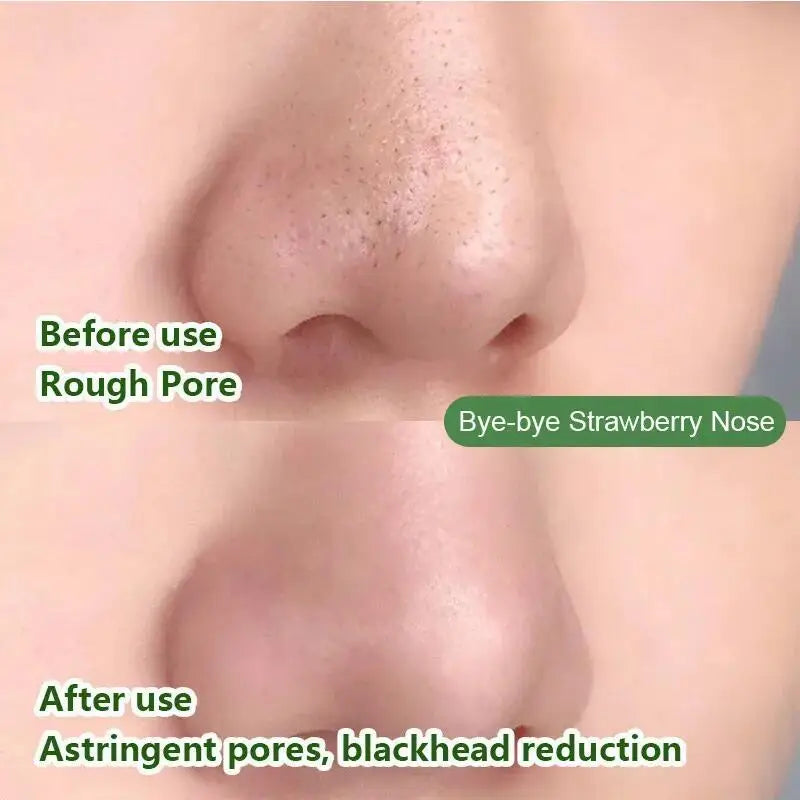 Green Tea Blackhead Remover Mask Stick