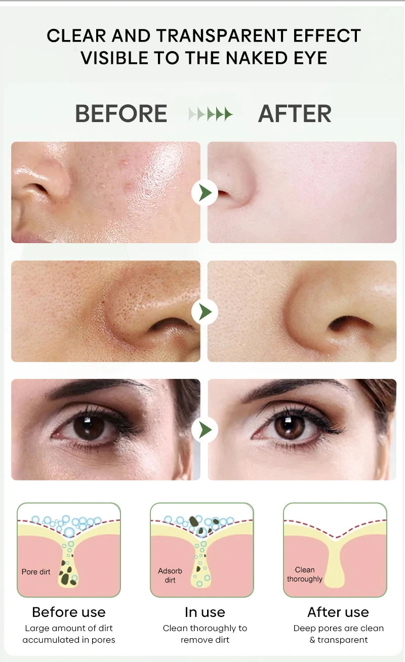 Green Tea Blackhead Remover Mask Stick