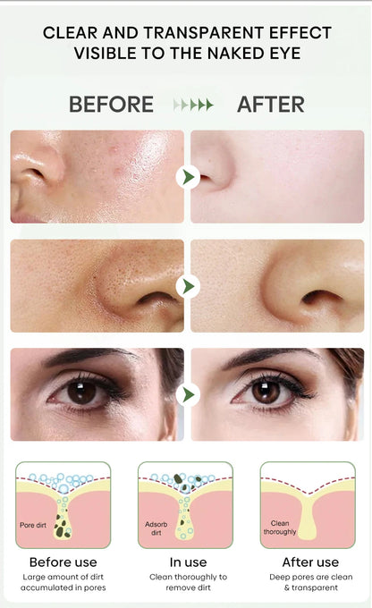Green Tea Blackhead Remover Mask Stick