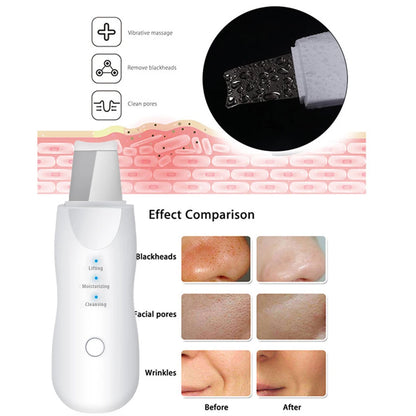 5-in-1 Ultrasonic Skin Scrubber &amp; Facial Beauty Kit – Deep Clean, Lift, Glow